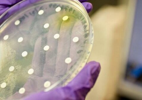 Cultivo bacteriano para diagnosticar prostatite